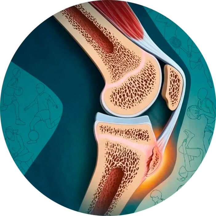 La struttura dell'articolazione e dei tessuti circostanti